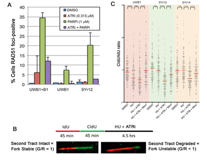 ATR Inhibition reverses major mechanisms of PARP inhibitor resistance. (A) HGSOC UWB1 BRCA1-mutant HGSOC cells with acquired resistance by virtue of BRCA1-add-back (B1) or with acquired resistance after chronic exposure to olaparib (SYr12) have restored HR, assayed by RAD51 focus formation in response to PARP inhibition, which is reversed with an ATR inhibitor. (B) DNA fiber assay for assessment of replication fork stability. (C) Compared with UWB1 parental cells, cells with acquired PARP inhibitor resistance (SYr12 and SYr14) have stabilized replication forks. Fork stabilization is reversed in the presence of an ATR inhibitor. From Yazinski et al, Genes Dev, 2017.