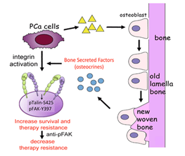 Model by which prostate tumor-induced woven bone contributes to therapy resistance.