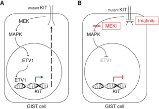 The KIT–ETV1-positive feedback circuit in GIST is interrupted by targeting ETV1 via inhibition of KIT and MAPK signaling