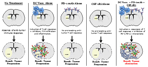 Figure for Project 1. Depiction of the critical immune components that regulate effective anti-tumor immune responses for malignant gliomas.
